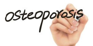 Osteoporosis -PhysioLeeds